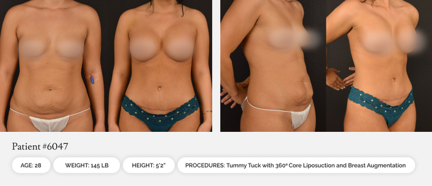 0a505941-before-afters-03-1_10or0b00or0ao000006000