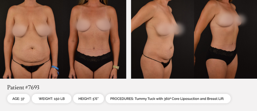 50a44c86-before-afters-02-1_10or0b00or0ao000006000