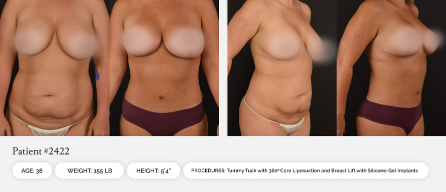 6127c888-before-afters-04-1_10or0b00or0ao000006000