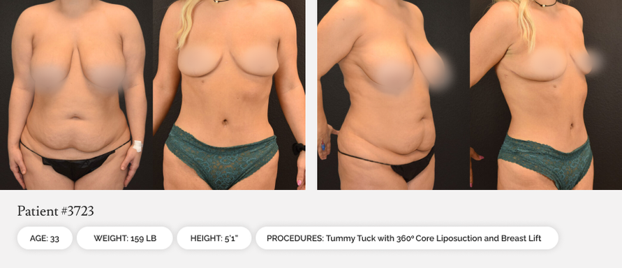 b09fcc4a-before-afters-01-1_10or0b00or0ao000006000