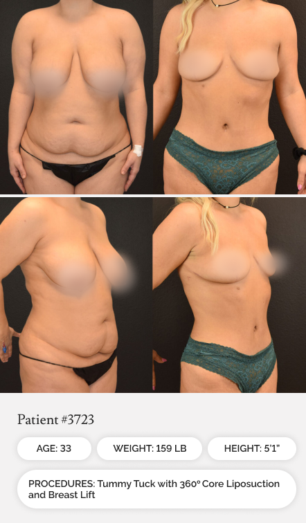 Before & Afters 01.1 - Mobile