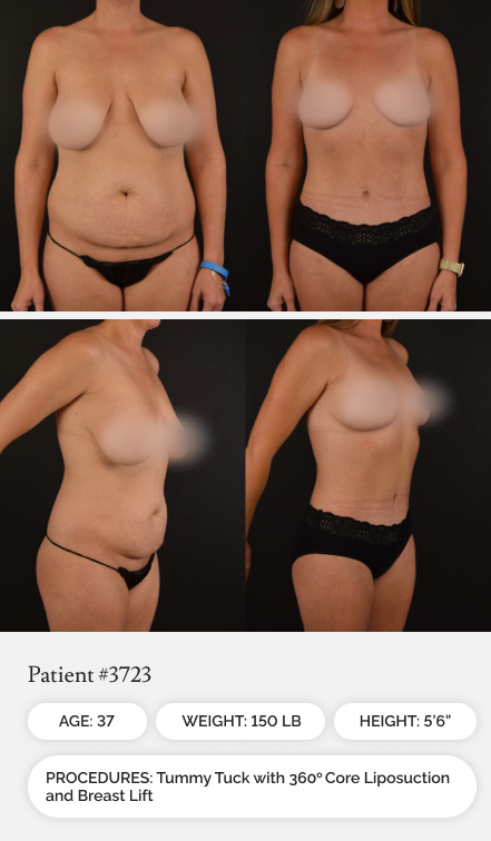 Before & Afters 02.1 - Mobile