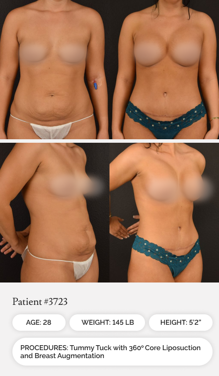 Before & Afters 03.1 - Mobile