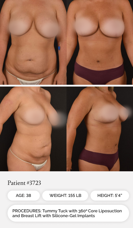 Before & Afters 04.1 - Mobile