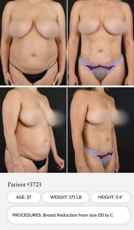 Before & Afters 05.1 - Mobile